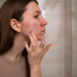How Pollution is Affecting Your Skin and Easy Solutions