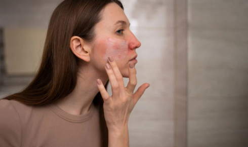 How Pollution is Affecting Your Skin and Easy Solutions